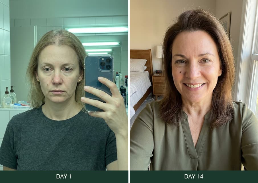 Before and after result 1